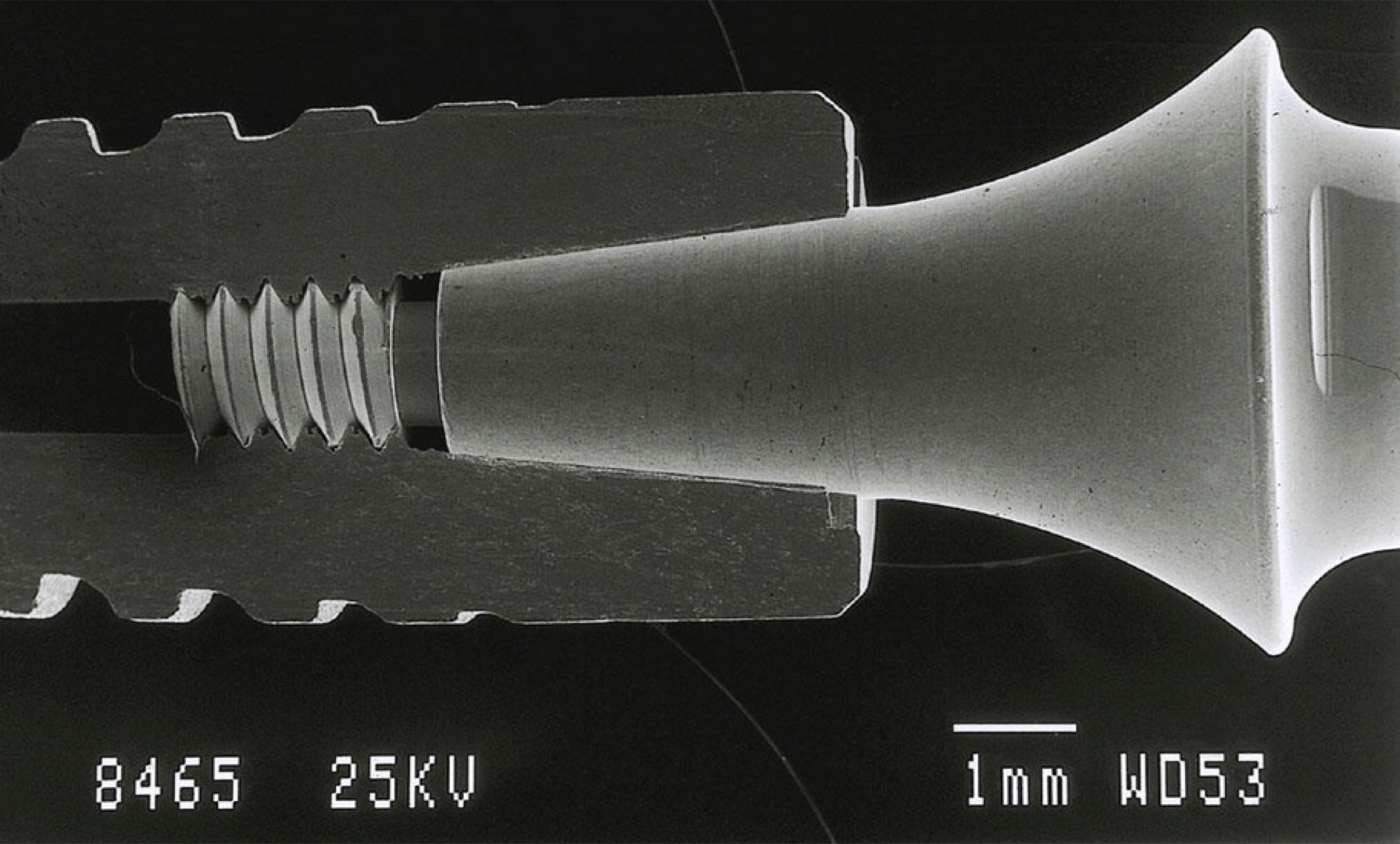 SEM Cross-Section of Ankylos® Implant-Bone Interface